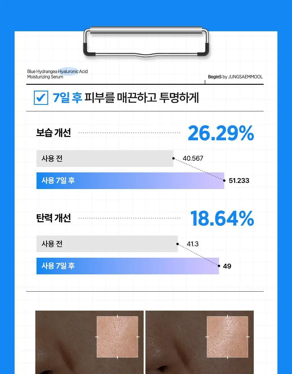 [10만나노히알/3초수분플럼핑]비긴스바이정샘물 블루 수국 히알 수분세럼 (30ml+10ml) 기획 상세페이지 13